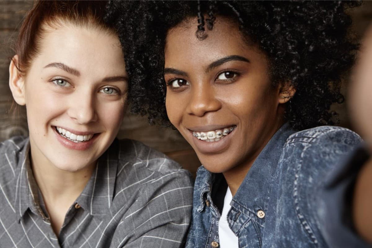 Seacoast Braces / Miller Orthodontics Becomes Sole Provider of Dynaflex Norris Self-Ligating Brackets in Dover and Exeter